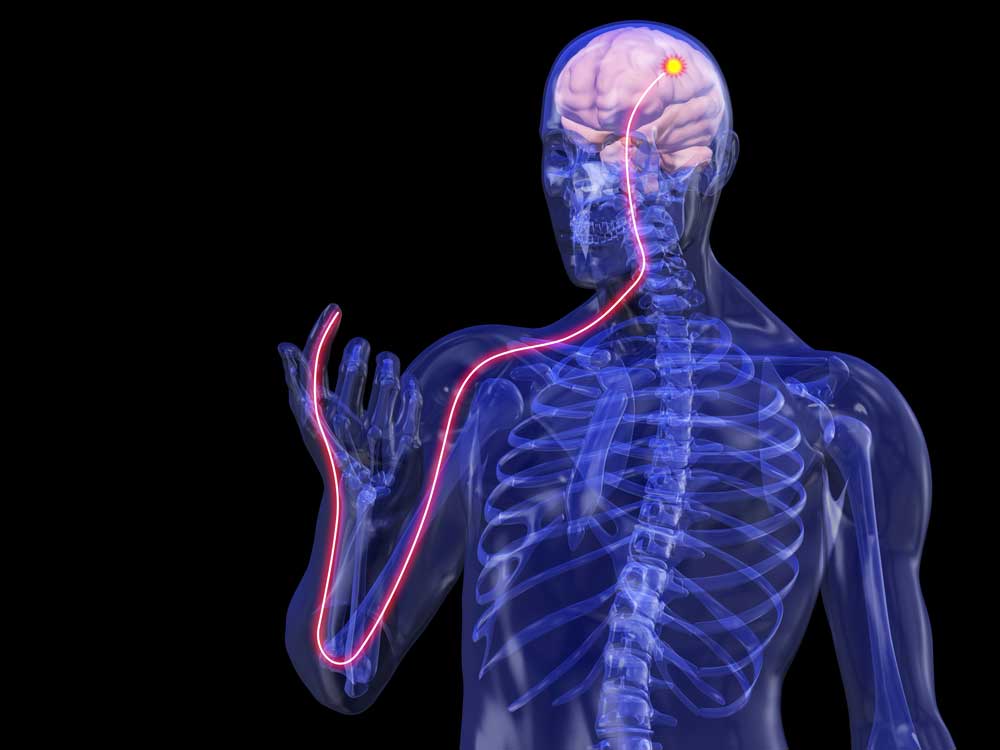 Illustrated x-ray of a skeleton and inflamed nerve
