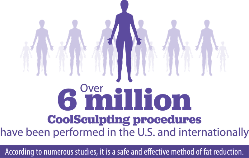 CoolSculpting infographic