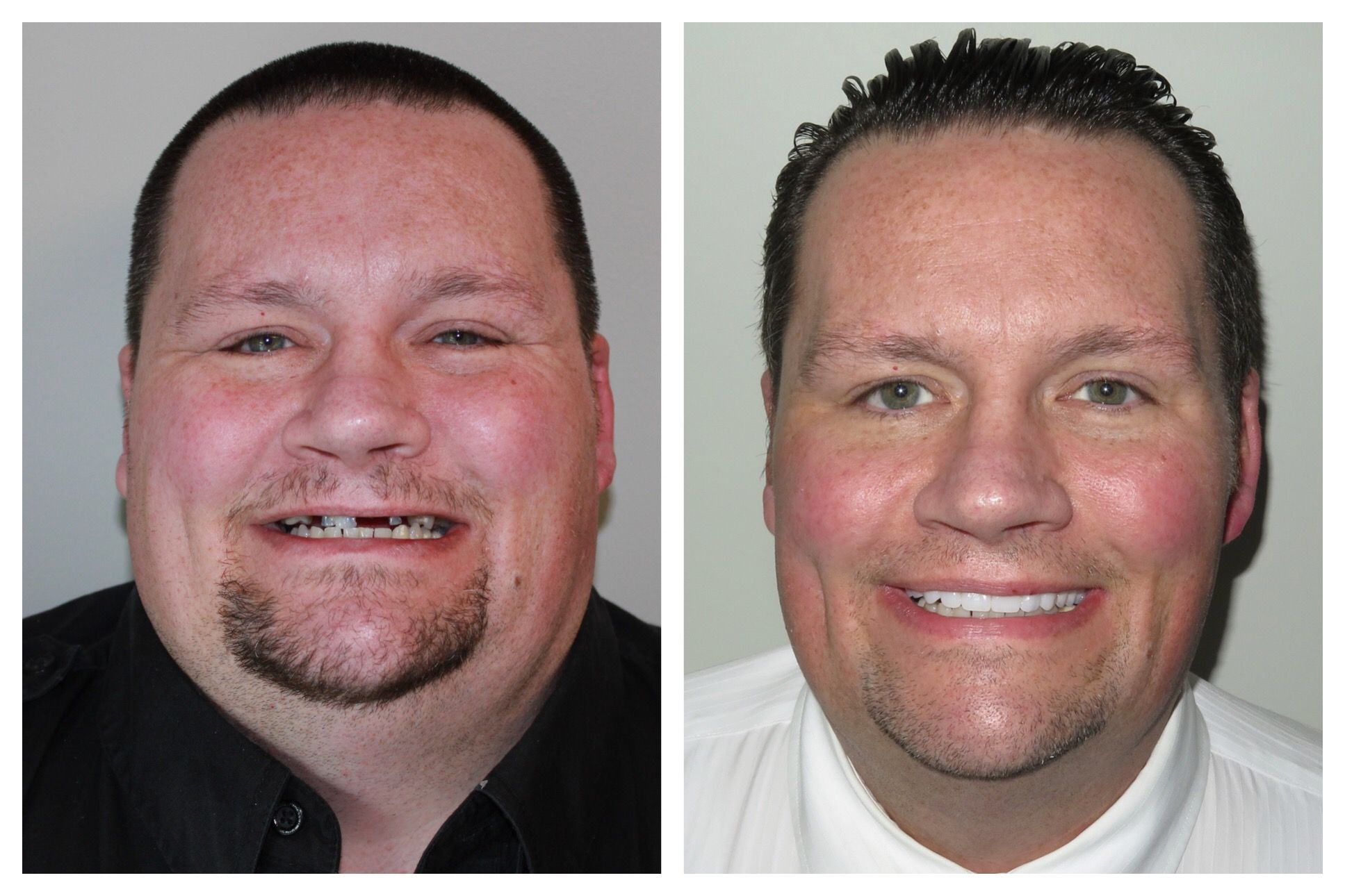 Before and after of male patient