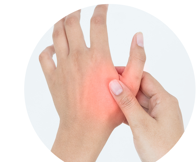 Person squeezing their thumb