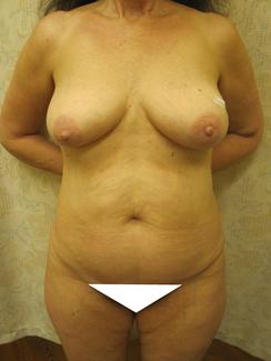 consult_white_triangle.jpg consult_white_triangle.jpg