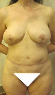 017_cropped_shaded_2.jpg 017_cropped_shaded_2.jpg