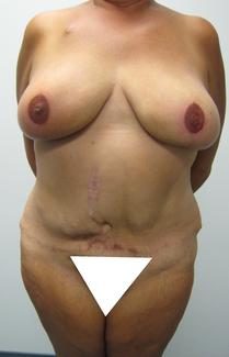 Post tattooing cropped_and_painted.jpg