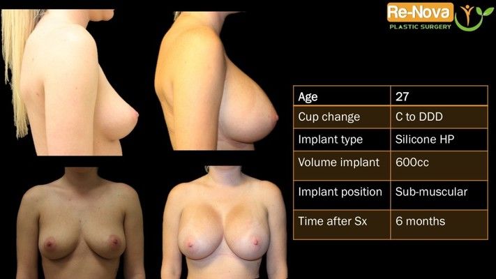 Before and after images.
