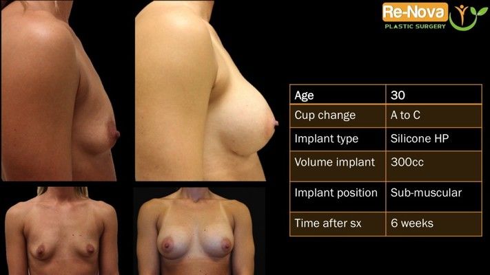 Before and after images.
