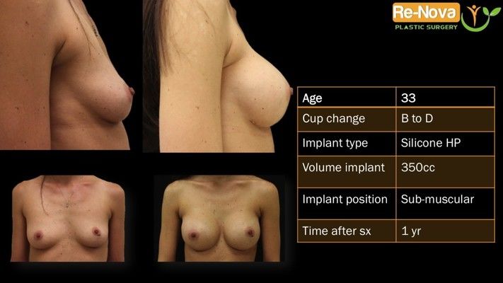 Before and after images.