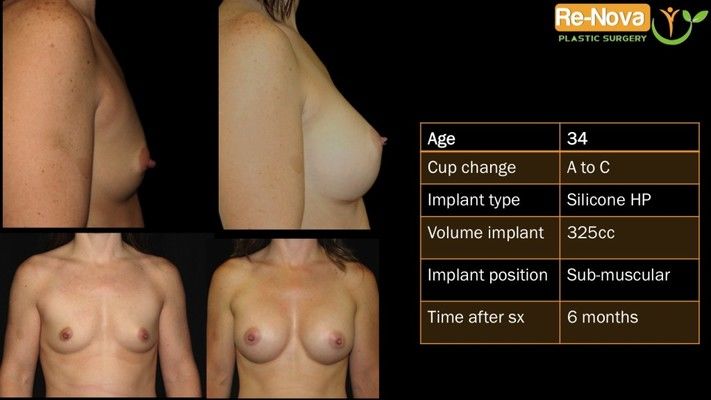 Before and after images.
