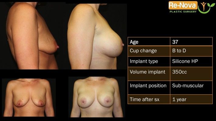 Before and after images.