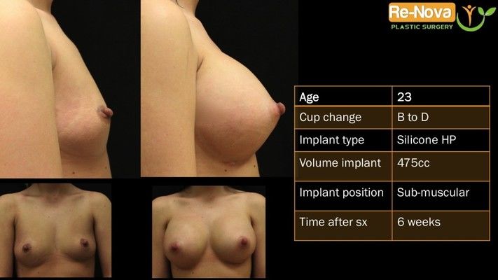 Before and after images.