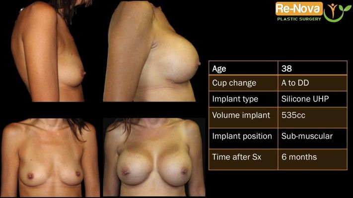 Before and after images.
