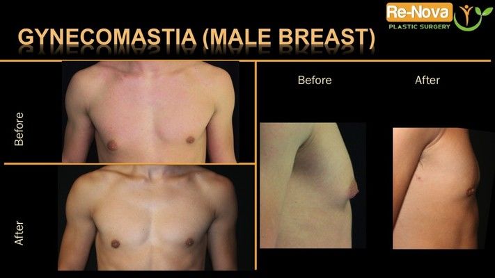 Before and after image.