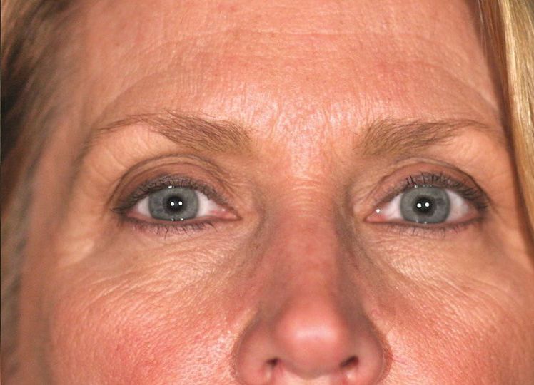 Before and after images.