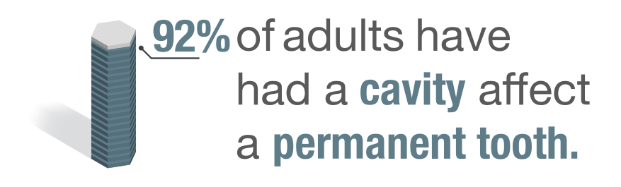 Infographic about cavities in adults