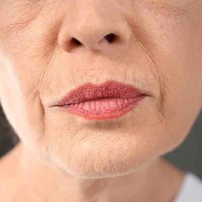 Close up of wrinkles around and on a woman's lips