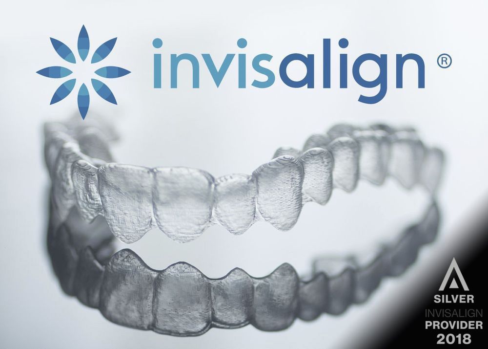 image of Invisalign clear aligners