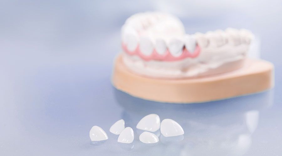 A denture in the background and veneers in the foreground