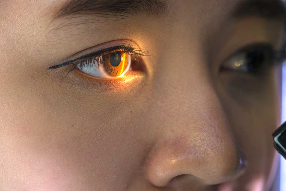 Close up of eye during exam