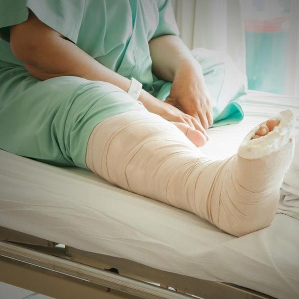 Patient with leg cast