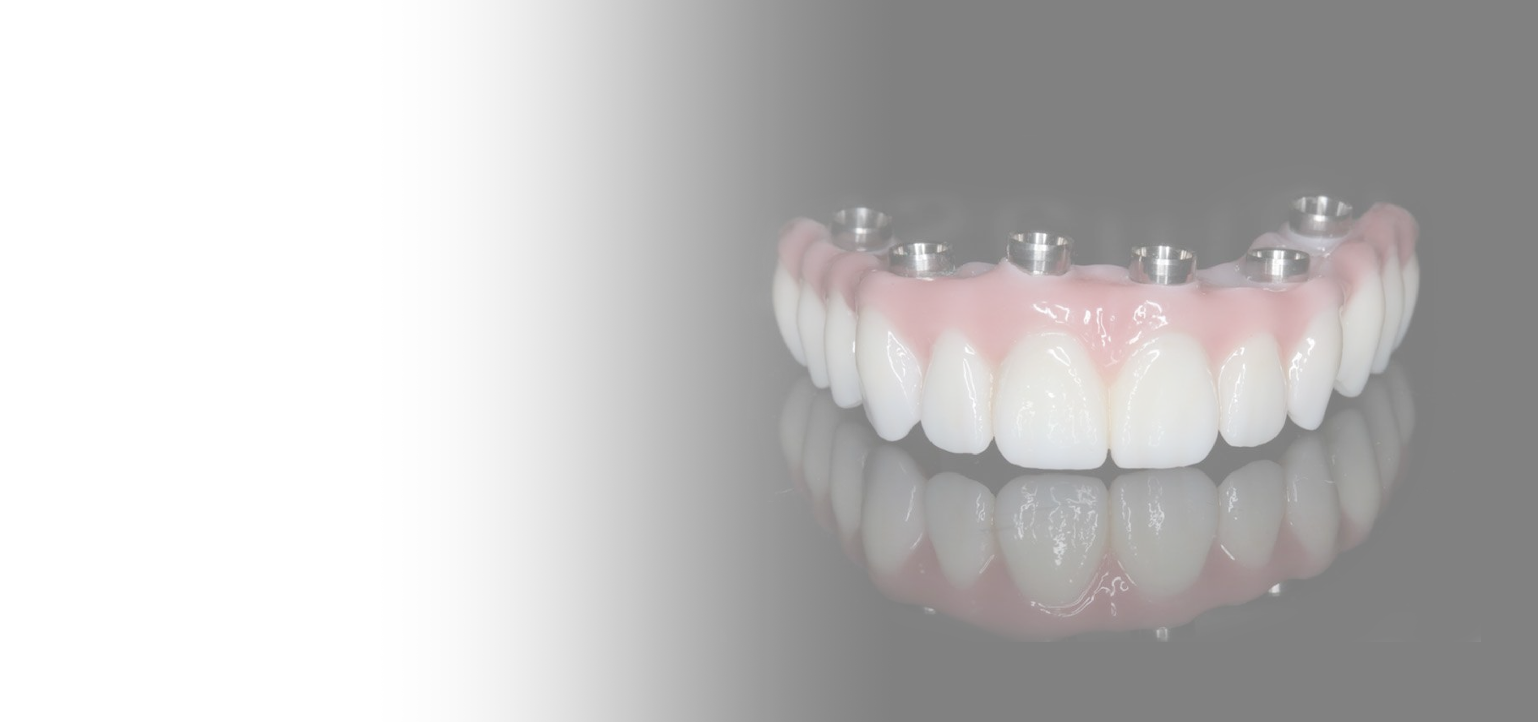 Prettau® Zirconia bridge