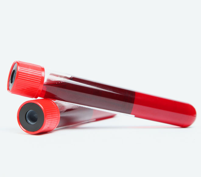 Vials of blood