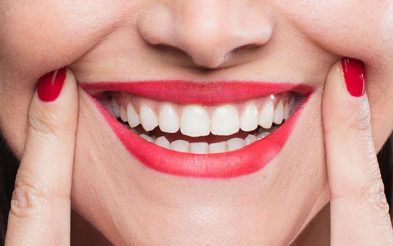 A woman pulls back her lips to show a beautiful smile.