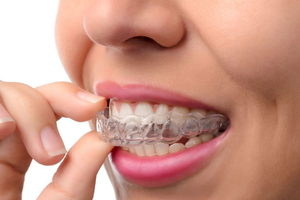 woman with Invisalign