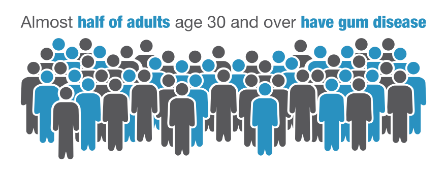 Gum disease infographic