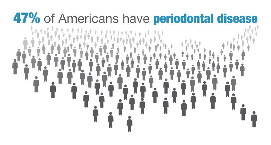 Gum disease infographic