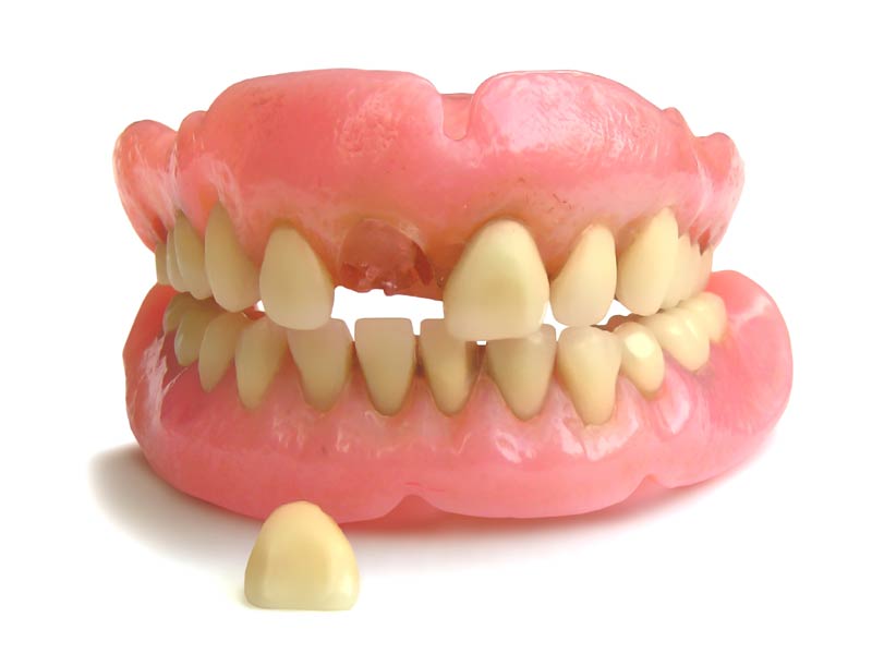 Dentures with a missing tooth on a plain reflective surface