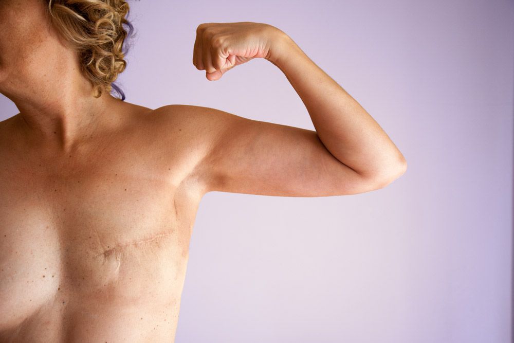 Patient undergoing a breast reconstruction consultation.