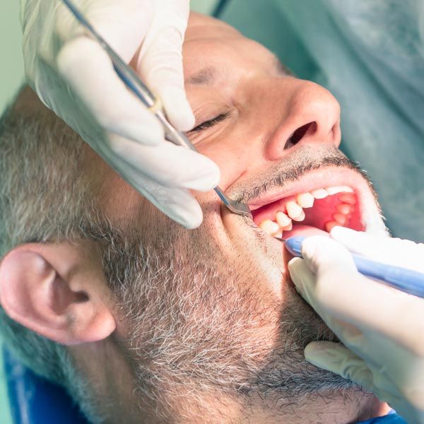 Man receiving dental cleaning