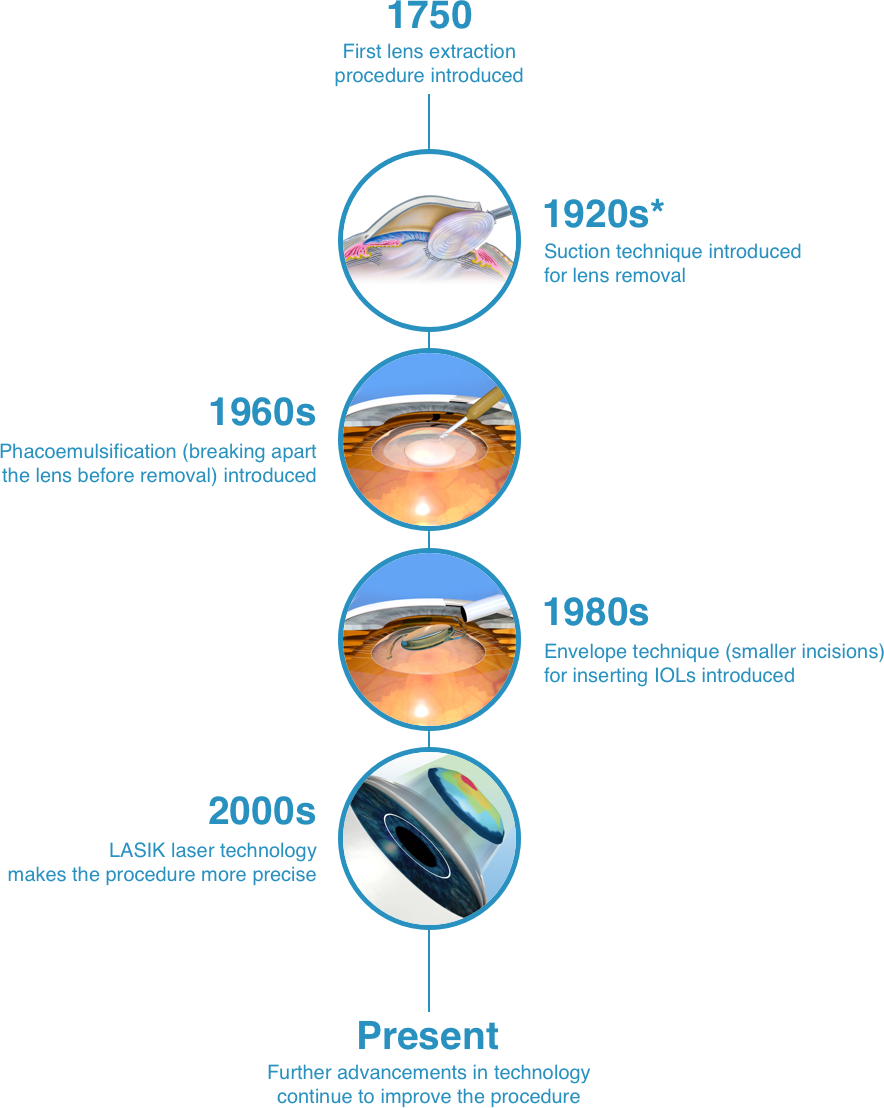 History of cataract surgery timeline