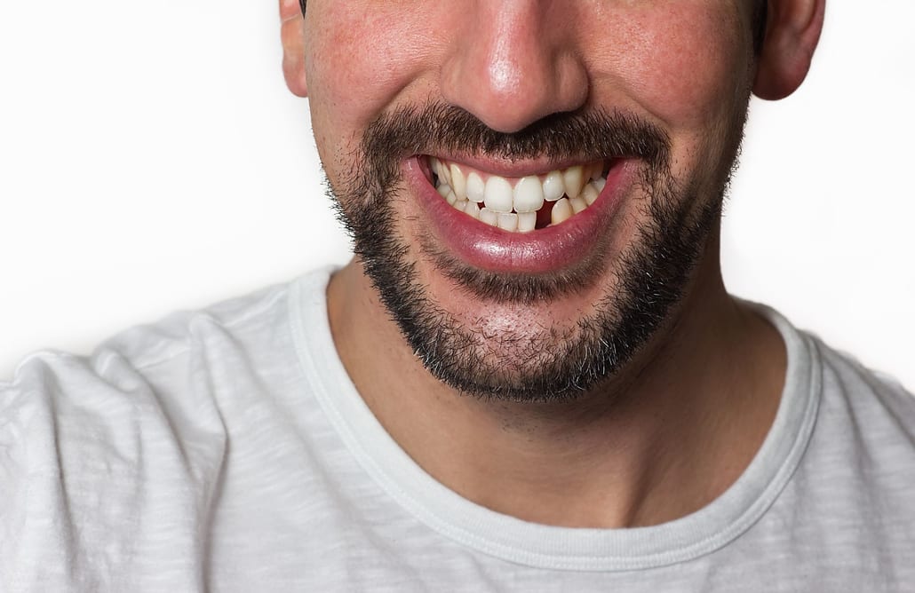 lost tooth