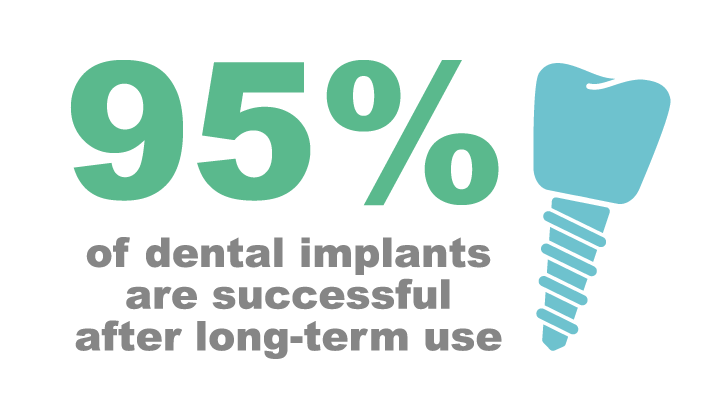 95% of dental implants are successful after long-term use