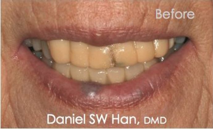 before dentistry