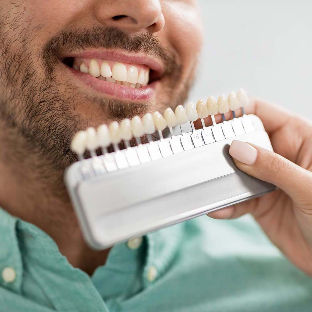 a doctor color-matching a patient's veneers