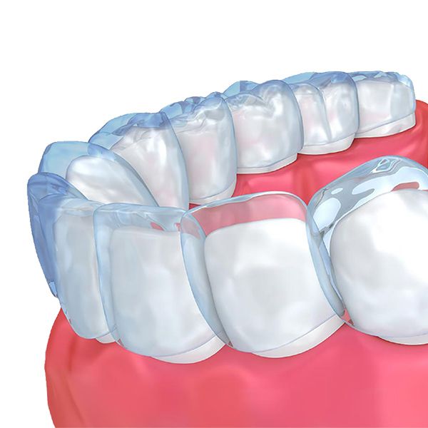 Invisalign®