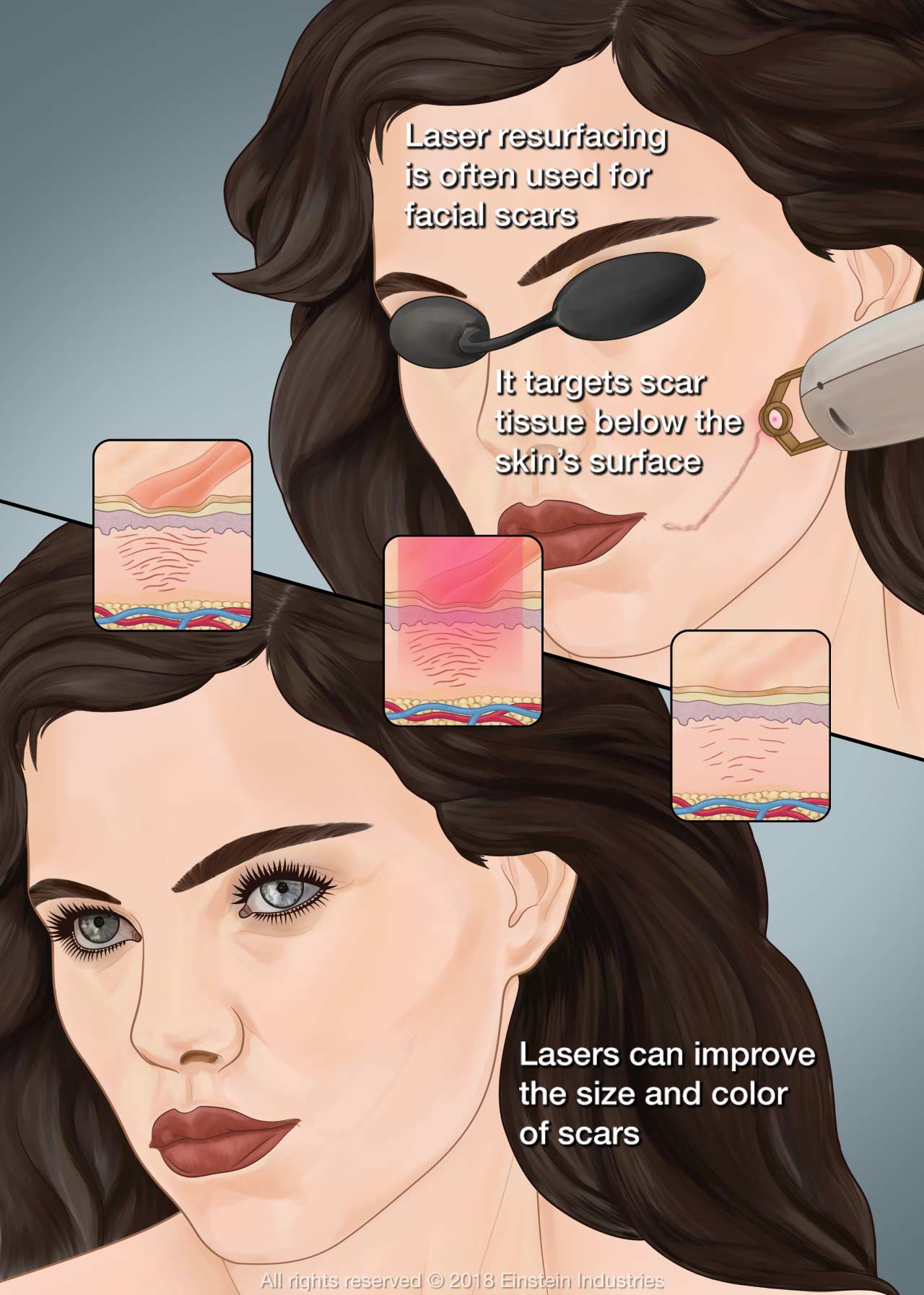 Right: Woman with shades on as she receives laser skin resurfacing treatment. Left: Woman with nearly invisible scar after treatment