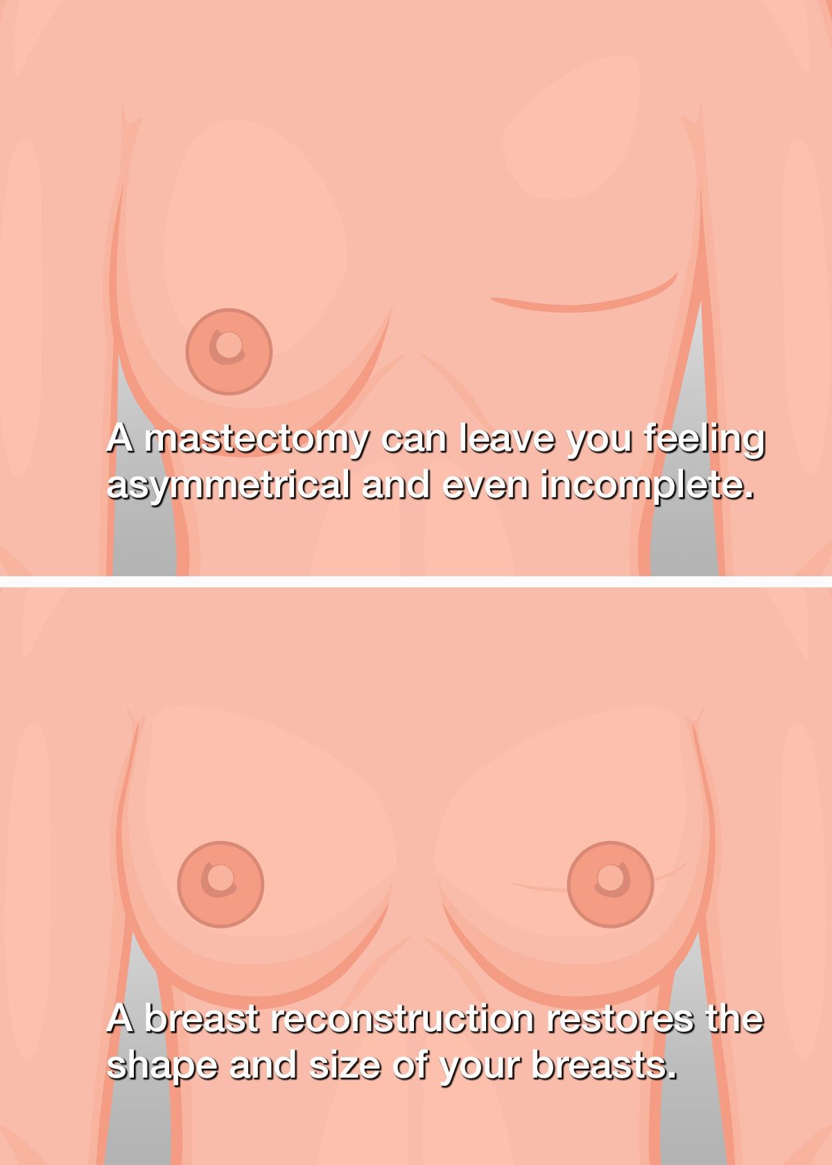 before and after a breast reconstruction