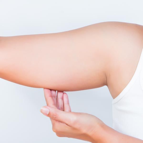 Liposuction for the Arms - Scottsdale, AZ
