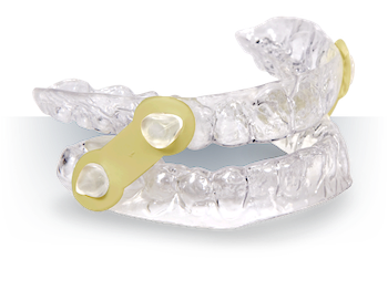 oral appliance