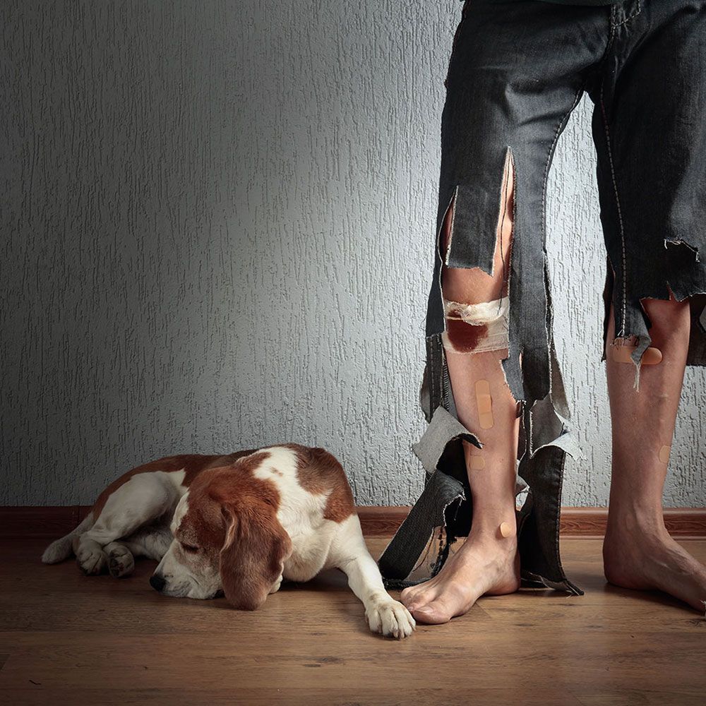 Dog lying next to man with tattered pants and bandaged legs