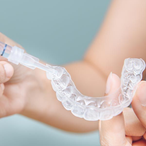 A person administering teeth whitening gel into custom trays