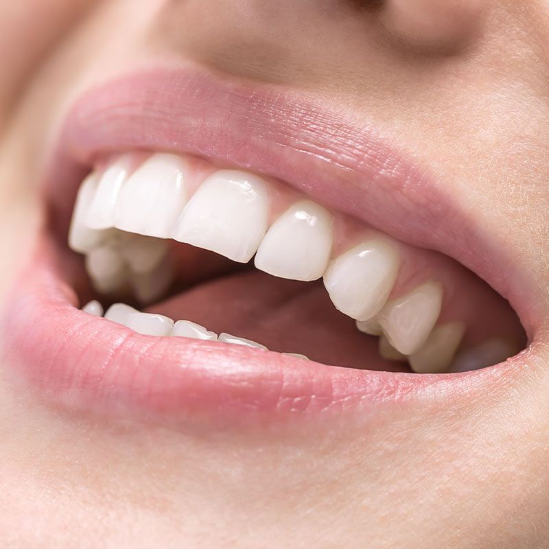 Close up of a patient's smile