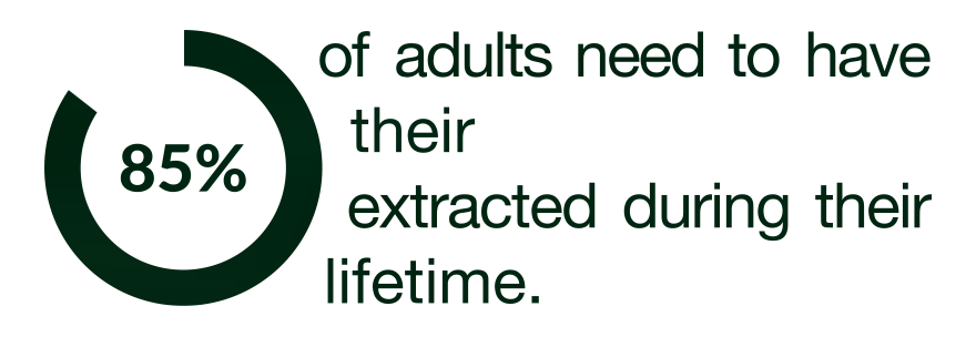 "85% of adults need to have their wisdom teeth extracted in their lifetime"