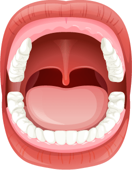 An illustration of missing front teeth