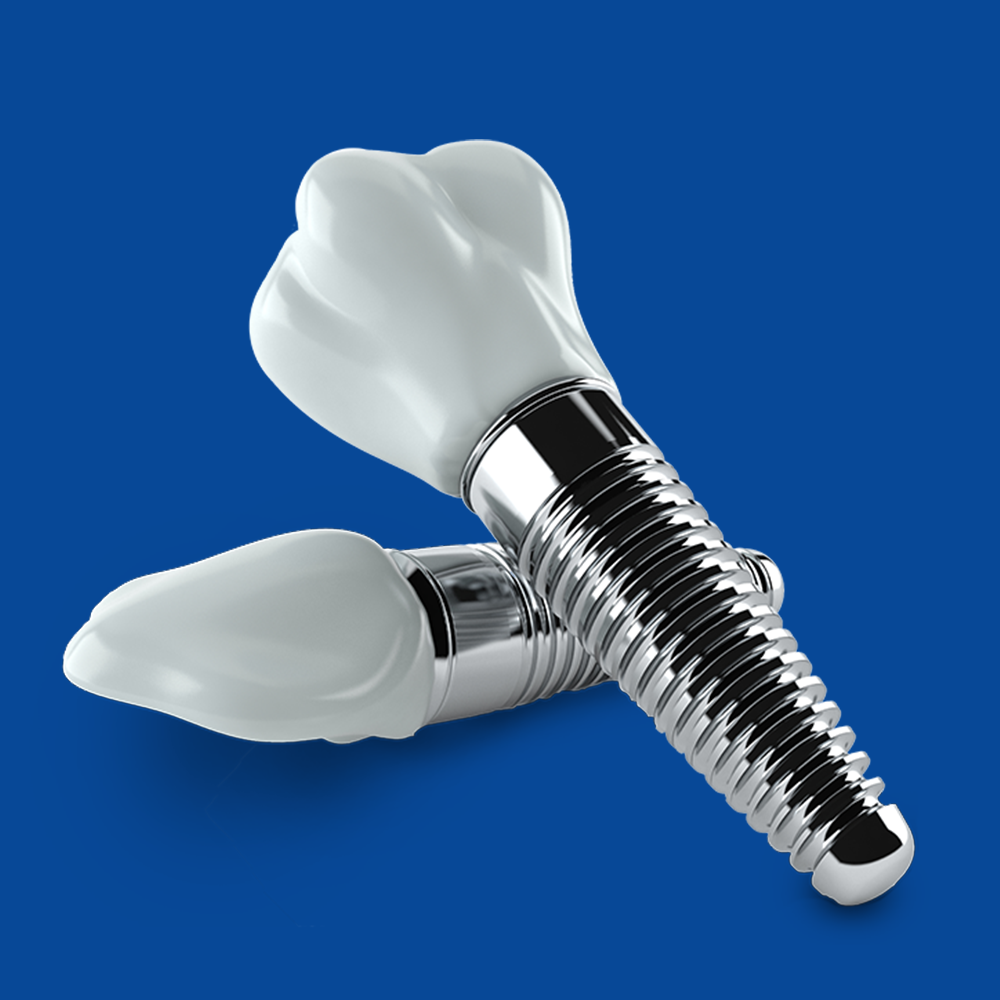 Dental Implant