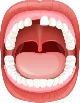 Illustration of missing teeth