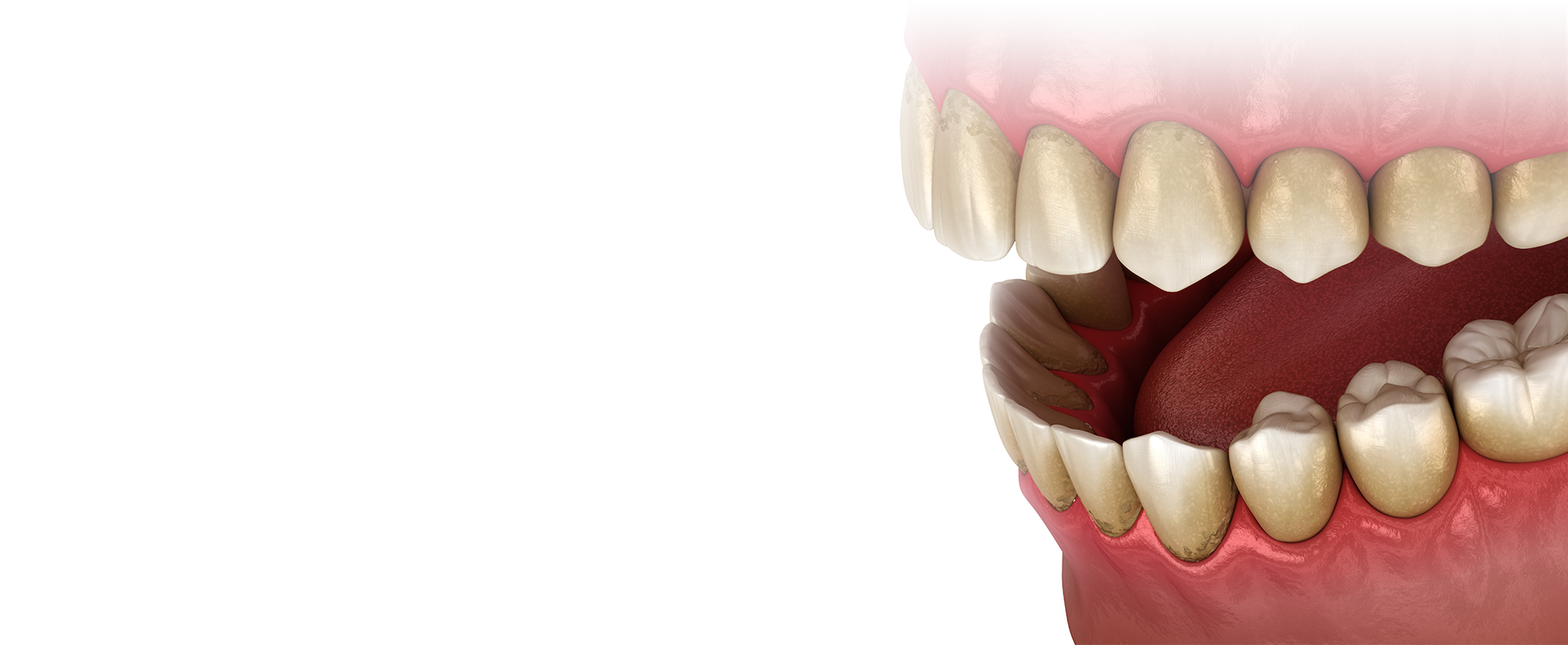 Illustration of gums