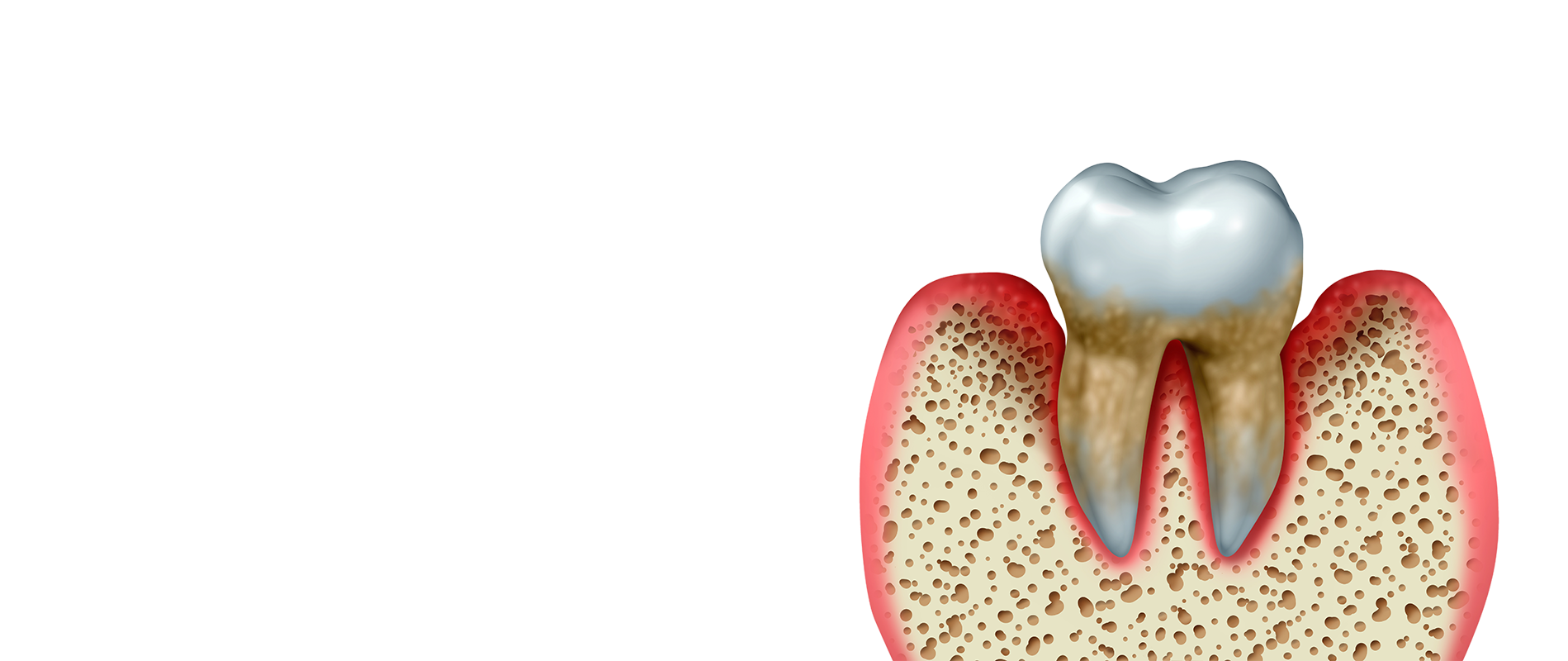 Illustration of gums
